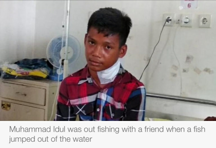 물고기에게 목을 찔린 소년 (충격이미지 주의) | 인스티즈