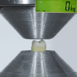 프레스로 치아 누르기.gif | 인스티즈