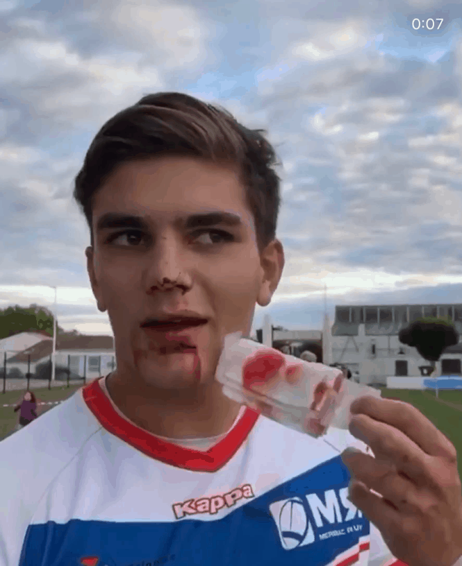 럭비가 이렇게나 위험합니다 | 인스티즈