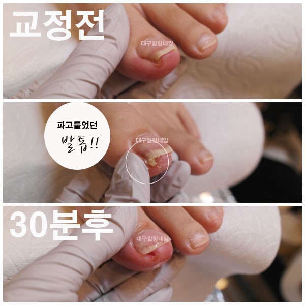 힐링네일 이미지