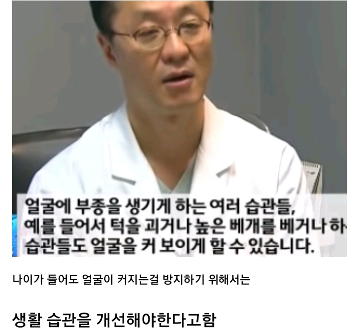 나이들수록 얼굴이 커지는 이유.jpg | 인스티즈