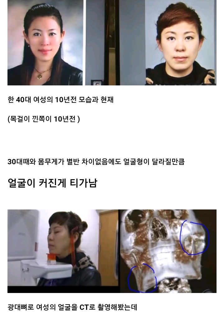 나이들수록 얼굴이 커지는 이유.jpg | 인스티즈