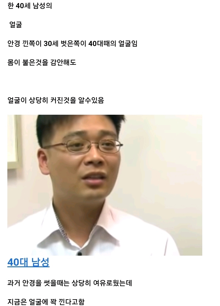 나이들수록 얼굴이 커지는 이유.jpg | 인스티즈