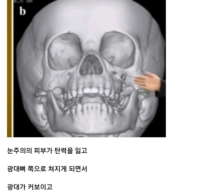나이들수록 얼굴이 커지는 이유.jpg | 인스티즈