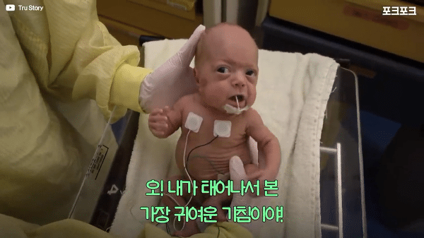 400g으로 태어난 26주 미숙아의 기적의 여정...JPG | 인스티즈