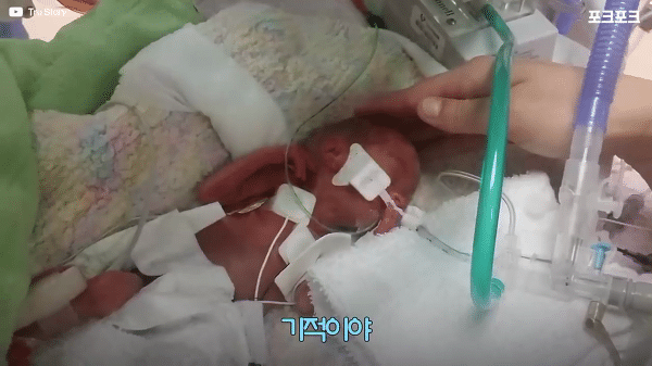 400g으로 태어난 26주 미숙아의 기적의 여정...JPG | 인스티즈