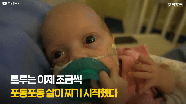 400g으로 태어난 26주 미숙아의 기적의 여정...JPG | 인스티즈