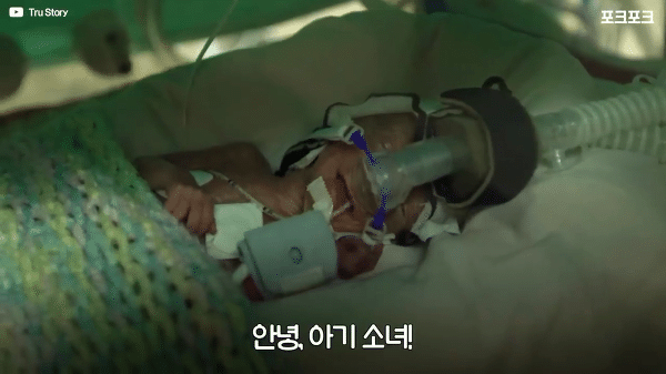 400g으로 태어난 26주 미숙아의 기적의 여정...JPG | 인스티즈