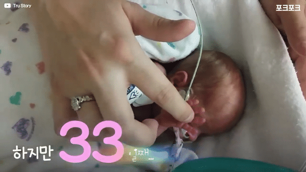 400g으로 태어난 26주 미숙아의 기적의 여정...JPG | 인스티즈