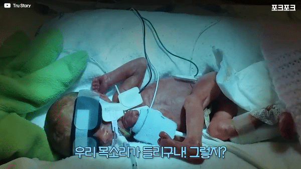 400g으로 태어난 26주 미숙아의 기적의 여정...JPG | 인스티즈