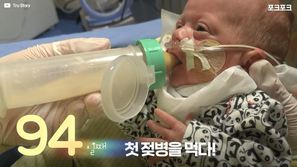 400g으로 태어난 26주 미숙아의 기적의 여정...JPG | 인스티즈