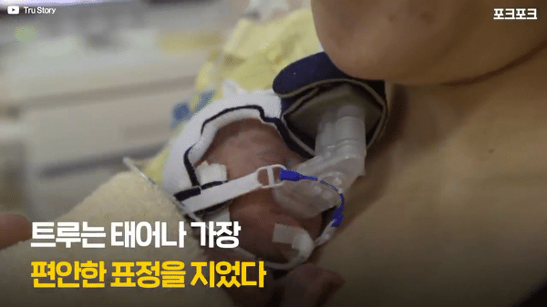 400g으로 태어난 26주 미숙아의 기적의 여정...JPG | 인스티즈