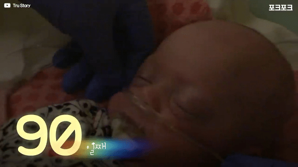 400g으로 태어난 26주 미숙아의 기적의 여정...JPG | 인스티즈