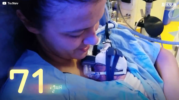 400g으로 태어난 26주 미숙아의 기적의 여정...JPG | 인스티즈