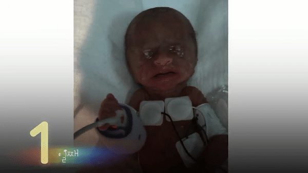 400g으로 태어난 26주 미숙아의 기적의 여정...JPG | 인스티즈