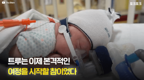 400g으로 태어난 26주 미숙아의 기적의 여정...JPG | 인스티즈