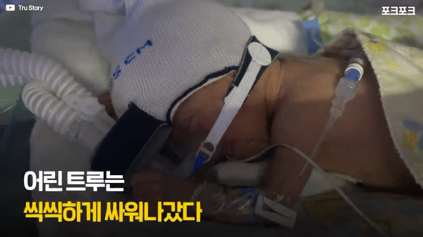 400g으로 태어난 26주 미숙아의 기적의 여정...JPG | 인스티즈