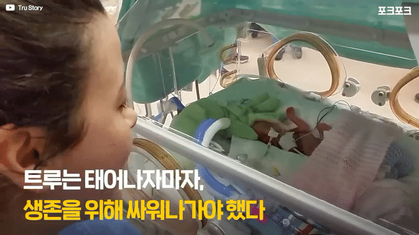400g으로 태어난 26주 미숙아의 기적의 여정...JPG | 인스티즈