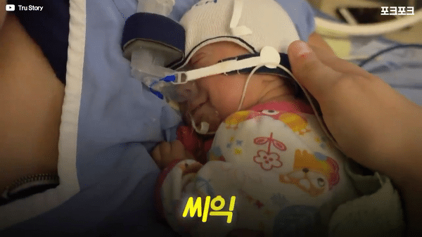 400g으로 태어난 26주 미숙아의 기적의 여정...JPG | 인스티즈