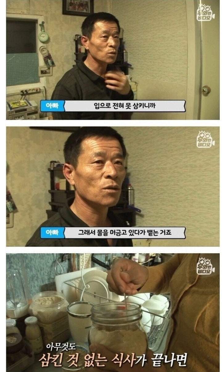 스압) 식도가 없이 태어난 아이.jpg | 인스티즈