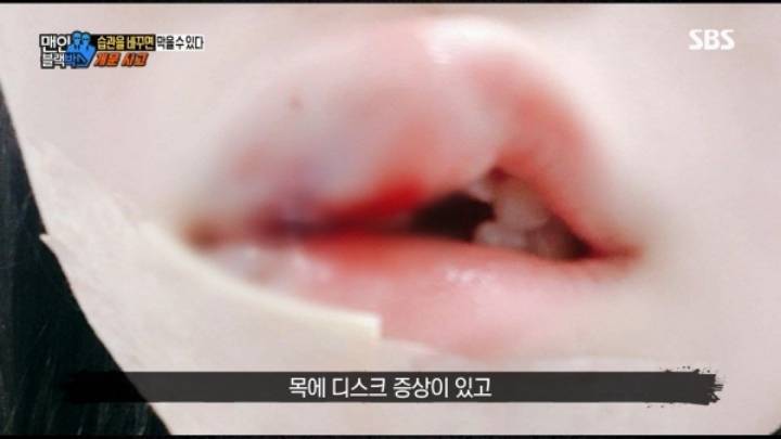 차 문 열 때 조심해야 하는 이유.gif | 인스티즈