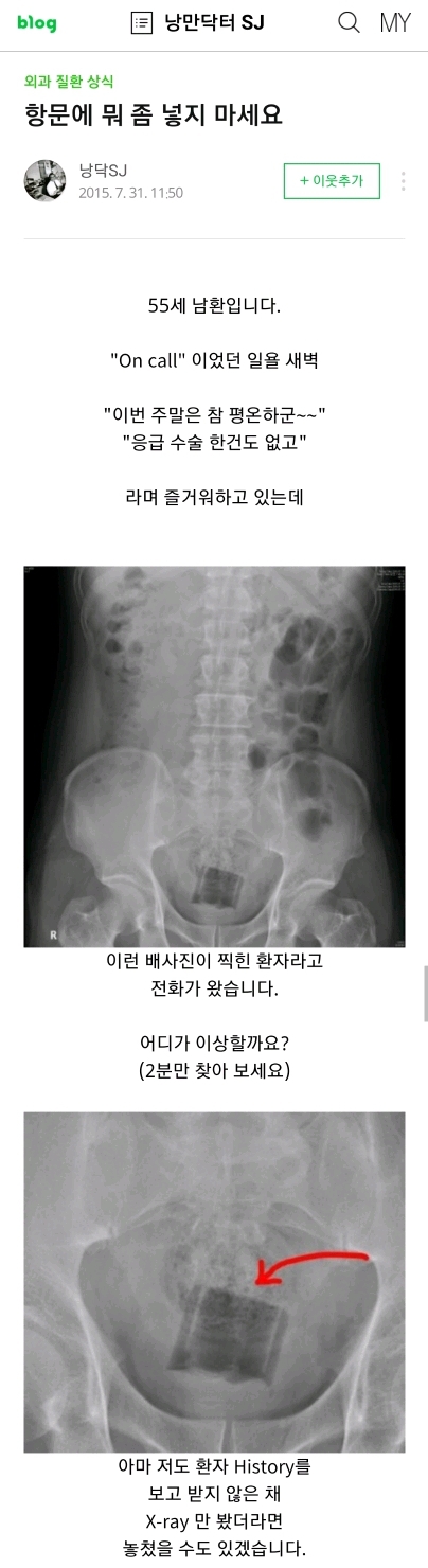 항문에 뭐좀 넣지마세요 (혐오주의) | 인스티즈