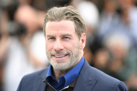 모발이식 성공사례 | 인스티즈