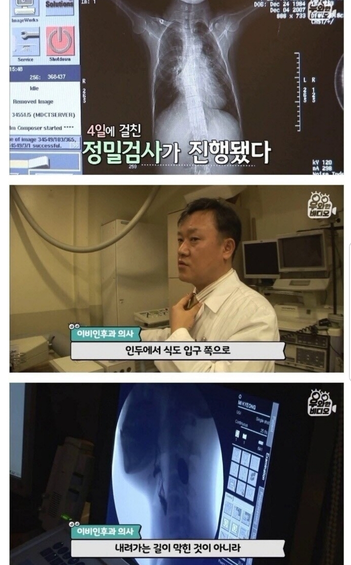 스압) 식도가 없이 태어난 아이.jpg | 인스티즈