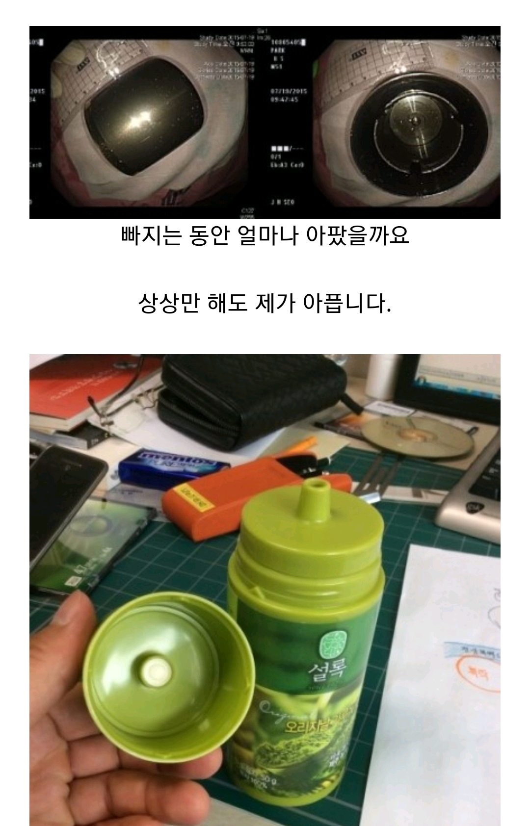 항문에 뭐좀 넣지마세요 (혐오주의) | 인스티즈