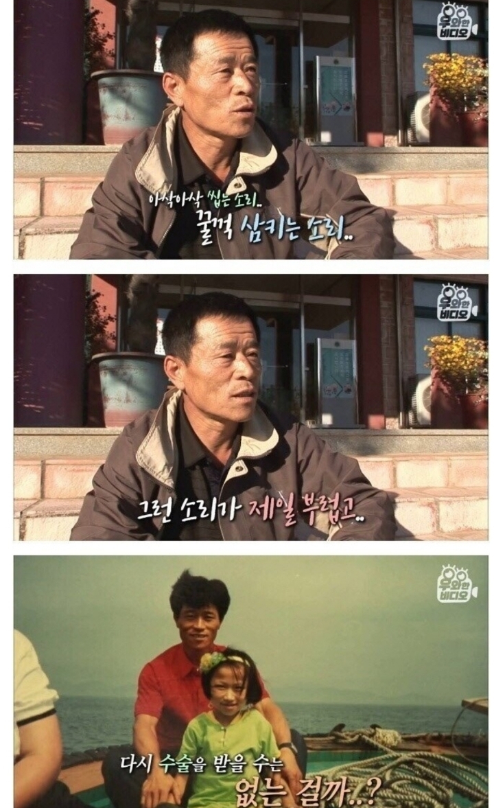 스압) 식도가 없이 태어난 아이.jpg | 인스티즈