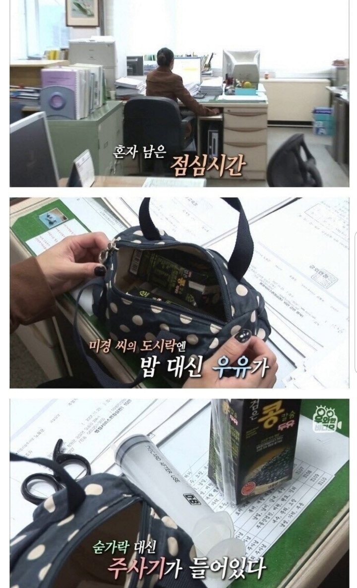 스압) 식도가 없이 태어난 아이.jpg | 인스티즈