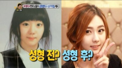 모태미녀의 고민 | 인스티즈
