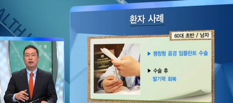 꼬추 이미지