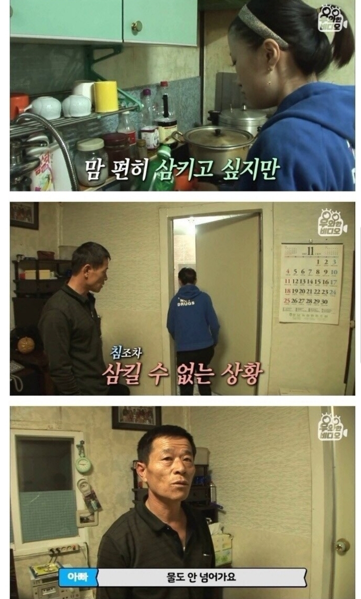 스압) 식도가 없이 태어난 아이.jpg | 인스티즈