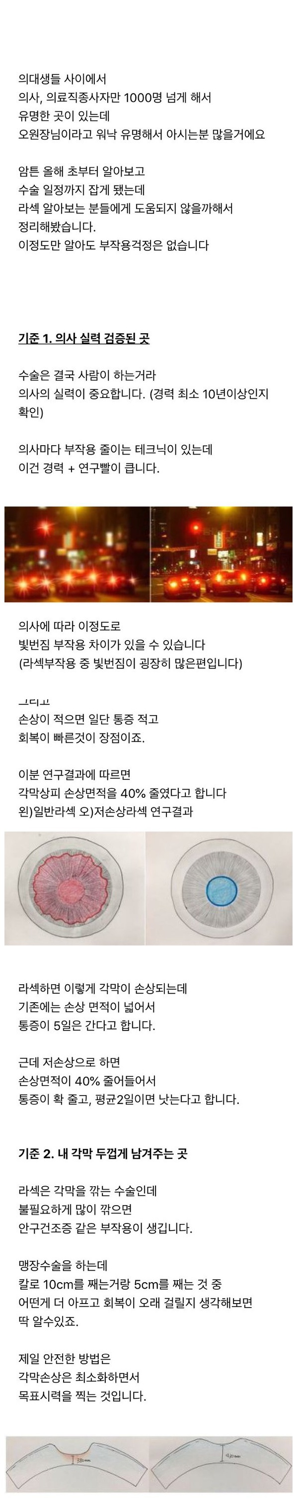 의대생이 알려주는 라식 정보.jpg | 인스티즈