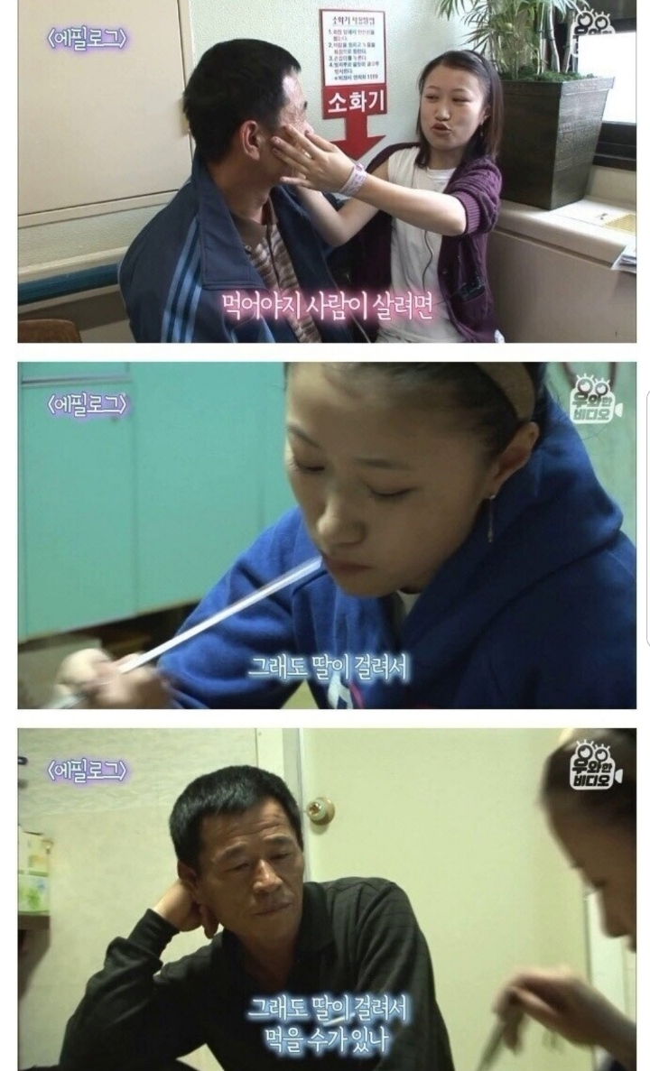 스압) 식도가 없이 태어난 아이.jpg | 인스티즈