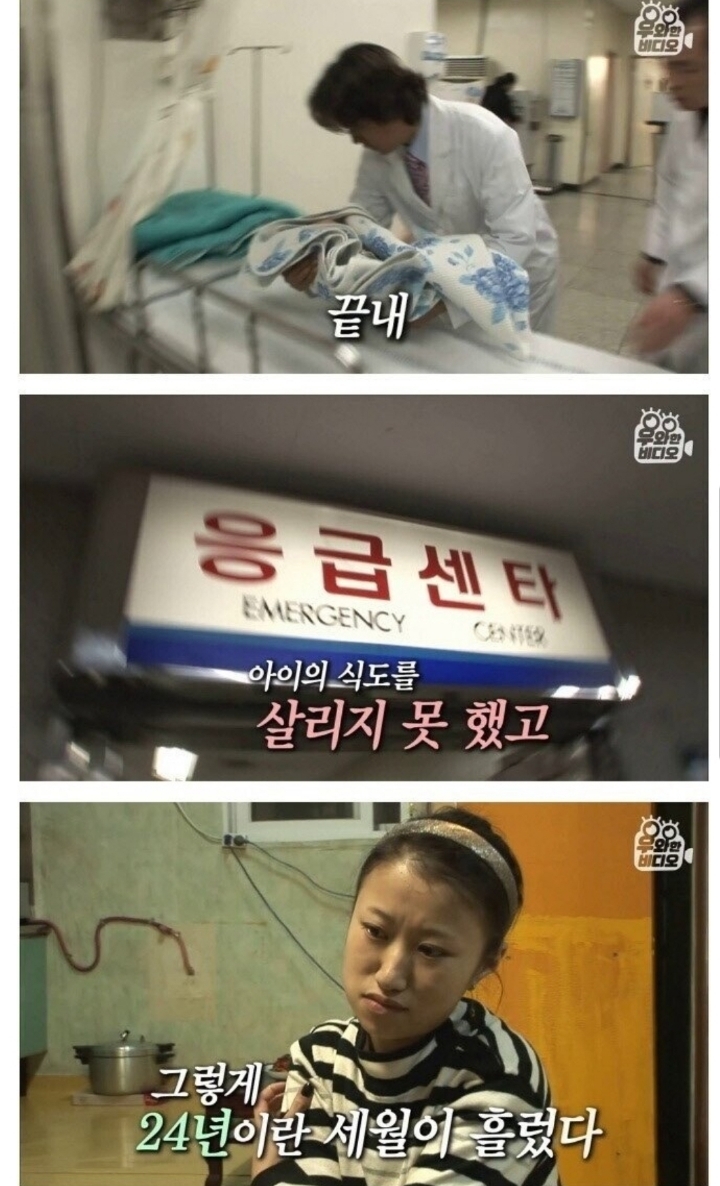 스압) 식도가 없이 태어난 아이.jpg | 인스티즈