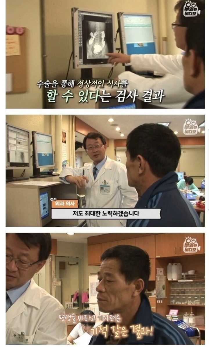 스압) 식도가 없이 태어난 아이.jpg | 인스티즈