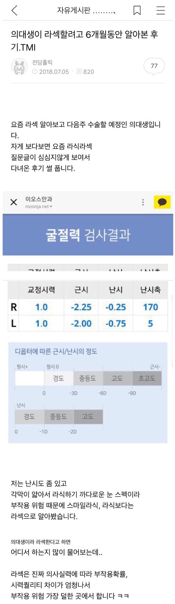 의대생이 알려주는 라식 정보.jpg | 인스티즈