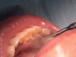 스케일링을 해야하는 이유 | 인스티즈