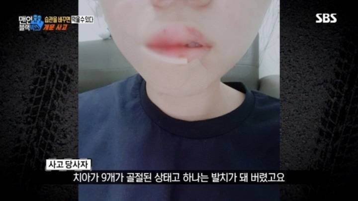 차 문 열 때 조심해야 하는 이유.gif | 인스티즈