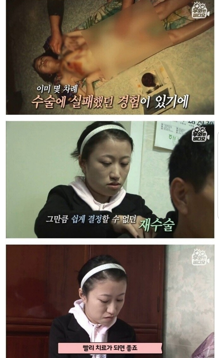 스압) 식도가 없이 태어난 아이.jpg | 인스티즈