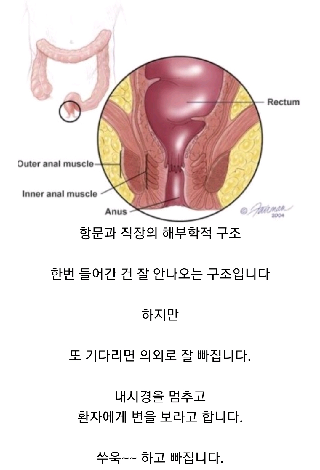 항문에 뭐좀 넣지마세요 (혐오주의) | 인스티즈