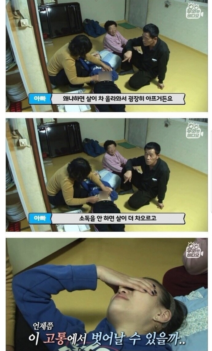 스압) 식도가 없이 태어난 아이.jpg | 인스티즈