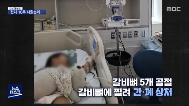 택배차에 치인 3살 아이(움짤 충격 주의) | 인스티즈