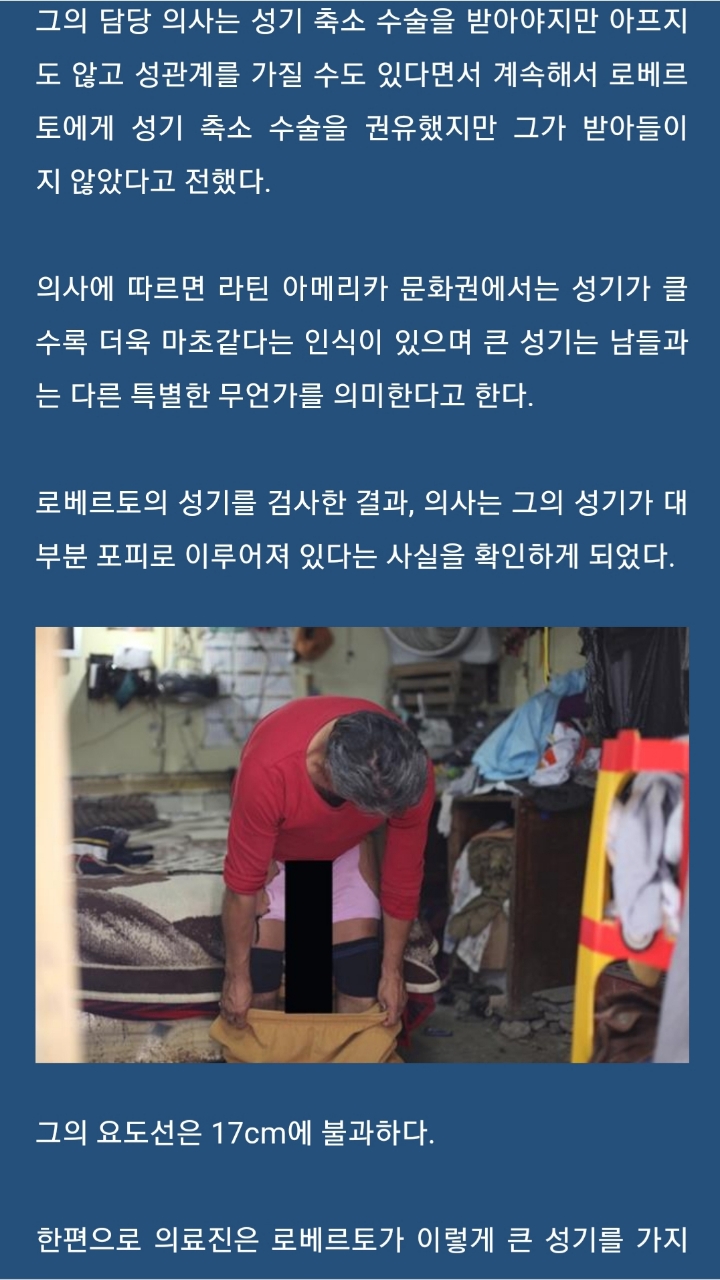 세계에서 가장 긴 페니스를 가진 남자 | 인스티즈