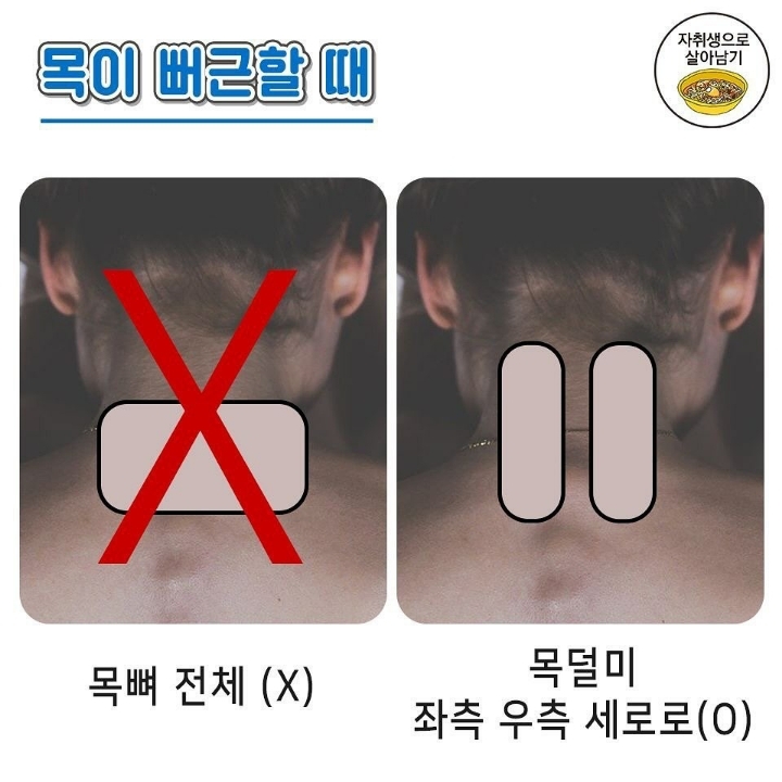 파스 붙이는 요령 | 인스티즈