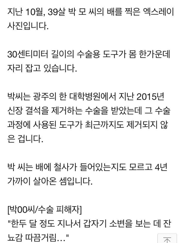 뱃속에 30cm 철사 있는데도 막 나가는 대학병원.jpg | 인스티즈