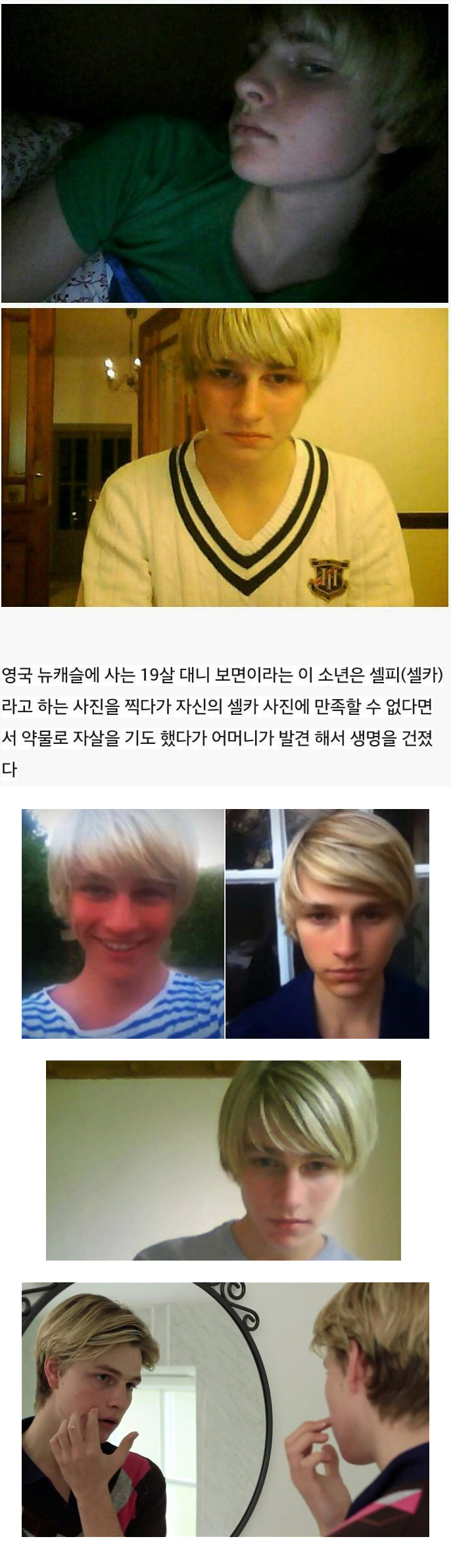 자신의 얼굴이 너무 못생겨서 자살 시도한 소년 | 인스티즈