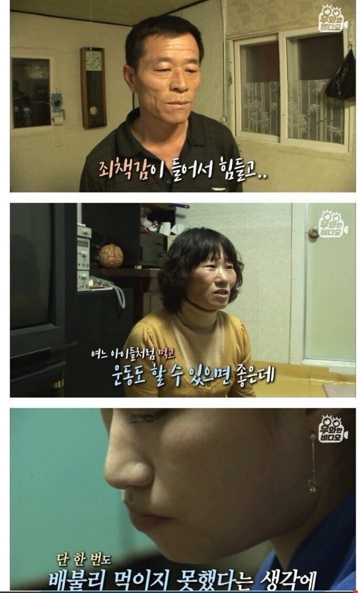 스압) 식도가 없이 태어난 아이.jpg | 인스티즈